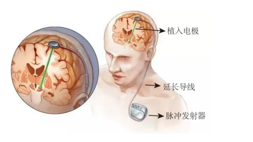 base64_image base64_image