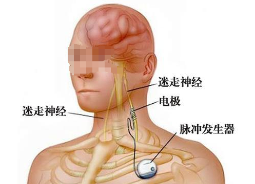 base64_image base64_image