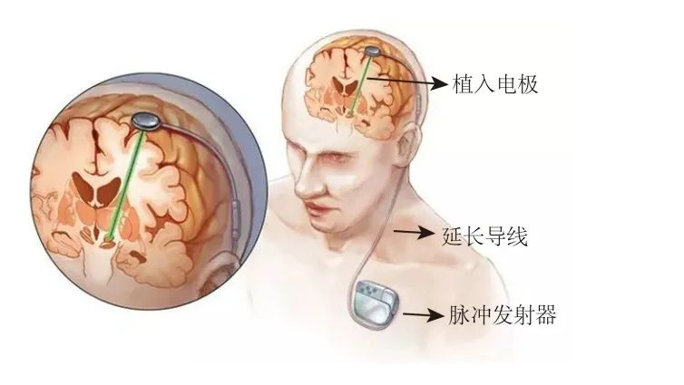 72918b4f43603cf98380af6a3aebb963 72918b4f43603cf98380af6a3aebb963